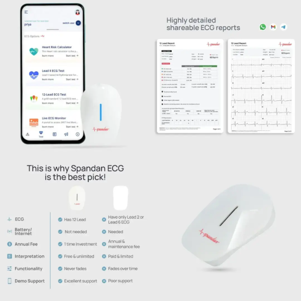 Spandan Legacy Portable 12-Lead ECG Device - ECG at Home