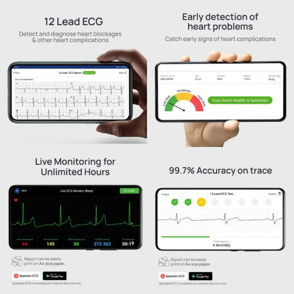 Spandan Legacy Portable 12-Lead ECG Device - ECG at Home